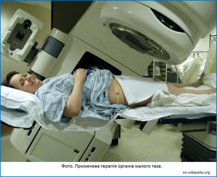 Radiation_therapy